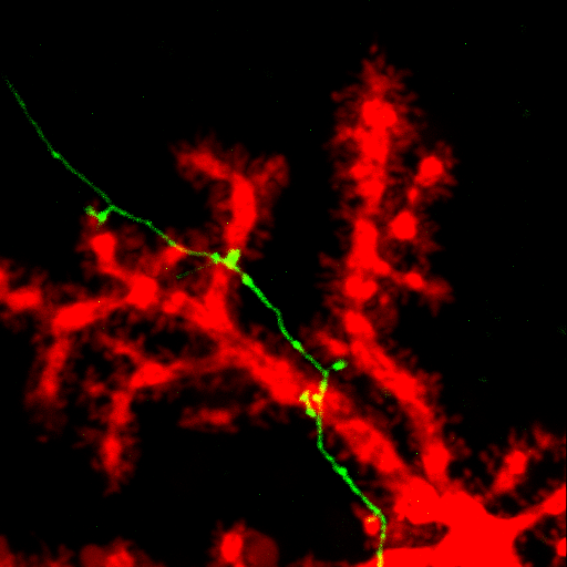 synapses between granule neuron and Purkinje neuron in the cerebellar culture